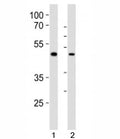 Western blot analysis of lysate from 1) human LNCaP and 2) mouse F9 cell line using Sox17 antibody at 1:1000. Predicted molecular weight ~45 kDa