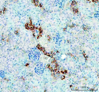 IHC staining of FFPE rat testis tissue with TIM-1 antibody. HIER: steam section in pH6 citrate buffer for 20 min.