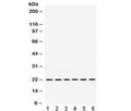Western blot testing of 1) rat spleen, 2) rat stomach, 3) rat intestine, 4) human MCF7, 5) human A549 and 6) human SKOV lysate with BIK antibody. Expected molecular weight ~18 kDa but routinely observed at 18-22 kDa.