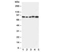 Western blot testing of CD18 antibody and Lane 1: Jurkat cell lysate ; 2: CEM; 3: HT1080; 4: SMMC-7721; 5: HeLa cell lysate.  Predicted/observed molecular weight: 85~95 kDa depending on glycosylation level.