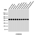 Western blot analysis of Human Brain, Mouse Brain, Rat Brain, Hamster Brain, Guinea pig Brain, Human Stomach, Mouse Stomach, Rat Stomach, Hamster Stomach and Guinea pig Stomach tissue lysates using recombinant CKBB antibody (clone rCKBB/8844). Predicted molecular weight ~43 kDa.