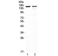 Western blot testing of 1) rat heart and 2) mouse heart lysate with MYBPC3 antibody at 0.5ug/ml. Predicted molecular weight ~147 kDa.