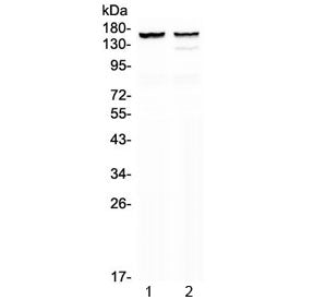 Western blot testing of 1) rat heart and 2) mouse heart lysate with MYBPC3 antibody at 0.5ug/ml. Predicted molecular weight ~147 kDa.