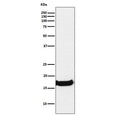 Western blot testing of human A549 cell lysate with Uteroglobin antibody. Expected molecular weight: 10-16 kDa.