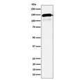 Western blot testing of human HepG2 cell lysate with Phospholipase C-beta-1 antibody. Predicted molecular weight ~139 kDa.