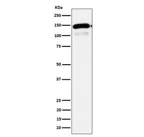 Western blot testing of human HepG2 cell lysate with Phospholipase C-beta-1 antibody. Predicted molecular weight ~139 kDa.