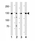 Western blot testing of human samples 1) K562 and 2) lung lysate and mouse samples 3) kidney and 4) heart lysate with ROR1 antibody at 1:1000. Predicted molecular weight of ROR1 isoforms: 105 kDa and 130 kDa.