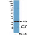 Western blot of Jurkat cell lysate, untreated or treated with Etoposide, using recombinant Caspase-3 antibody at 1:1000.