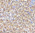 IHC staining of FFPE zebrafish liver tissue with Fasn antibody, HRP-labeled secondary and DAB substrate. HIER: boil tissue sections in pH8 EDTA for 20 min and allow to cool before testing.