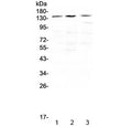 Western blot testing of human 1) HeLa, 2) SGC-7901 and 3) THP-1 cell lysate with TrkA antibdoy at 0.5ug/ml. Expected molecular weight: 85~140 kDa depending on glycosylation level.