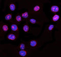 Immunofluorescent staining of NUP62 using anti-NUP62 antibody (red). NUP62 was detected in an immunocytochemical section of U2OS cells. Enzyme antigen retrieval was performed using IHC enzyme antigen retrieval reagent for 15 mins. The cells were blocked with 10% goat serum. And then incubated with 5 ug/ml rabbit anti-NUP62 antibody overnight at 4oC. Cy3 Conjugated Goat Anti-Rabbit IgG was used as secondary antibody at 1:500 dilution and incubated for 30 min at 37oC.