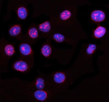 Immunofluorescent staining of NUP62 using anti-NUP62 antibody (red). NUP62 was detected in an immunocytochemical section of U2OS cells. Enzyme antigen retrieval was performed using IHC enzyme antigen retrieval reagent for 15 mins. The cells were blocked with 10% goat serum. And then incubated with 5 ug/ml rabbit anti-NUP62 antibody overnight at 4oC. Cy3 Conjugated Goat Anti-Rabbit IgG was used as secondary antibody at 1:500 dilution and incubated for 30 min at 37oC.
