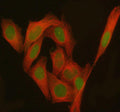 Immunofluorescent staining of PHF17/JADE1 using anti-JADE1 antibody (green) and anti-Beta Tubulin antibody (red). JADE1 was detected in immunocytochemical section of human HeLa cells. Enzyme antigen retrieval was performed using IHC enzyme antigen retrieval reagent for 15 mins. The cells were blocked with 10% goat serum. And then incubated with 5 ug/ml rabbit anti-JADE1 antibody and mouse anti-Beta Tubulin antibody overnight at 4oC.