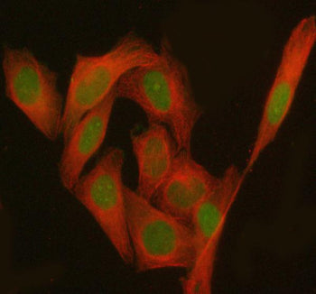Immunofluorescent staining of PHF17/JADE1 using anti-JADE1 antibody (green) and anti-Beta Tubulin antibody (red). JADE1 was detected in immunocytochemical section of human HeLa cells. Enzyme antigen retrieval was performed using IHC enzyme antigen retrieval reagent for 15 mins. The cells were blocked with 10% goat serum. And then incubated with 5 ug/ml rabbit anti-JADE1 antibody and mouse anti-Beta Tubulin antibody overnight at 4oC.