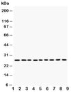 Western blot testing of Kallikrein 6 antibody and human lysate samples: 1) MCF-7; 2) HeLa; 3) MM231; 4) MM453; 5) A549; 6) SMMC-7721; 7) COLO320; 8) SW620; 9) HT1080. Predicted molecular weight: ~27 kDa.