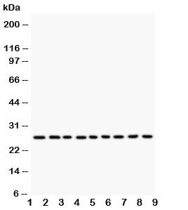 Western blot testing of Kallikrein 6 antibody and human lysate samples: 1) MCF-7; 2) HeLa; 3) MM231; 4) MM453; 5) A549; 6) SMMC-7721; 7) COLO320; 8) SW620; 9) HT1080. Predicted molecular weight: ~27 kDa.