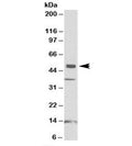 Western blot testing of human frontal cortex lysate with NPTX1 antibody at 1ug/ml. Predicted molecular weight: ~47kDa. The three observed bands are blocked by addition of immunizing peptide.