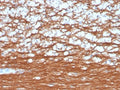 IHC staining of FFPE human cerebellum with recombinant PGP9.5 antibody (clone rUCHL1/4557). HIER: boil tissue sections in pH 9 10mM Tris with 1mM EDTA for 20 min and allow to cool before testing.