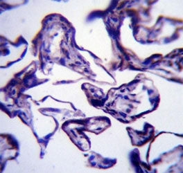 LEP antibody immunohistochemistry analysis in formalin fixed and paraffin embedded human placenta tissue.