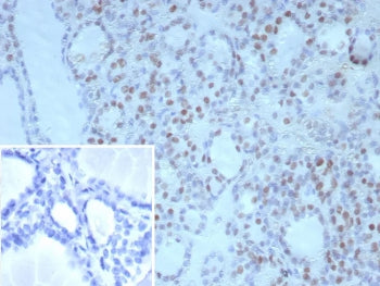 IHC staining of FFPE human thyroid tissue with NKX2.1 antibody (clone NX2.1/9030). Inset: PBS used in place of primary Ab (secondary Ab negative control). HIER: boil tissue sections in pH 9 10mM Tris with 1mM EDTA for 20 min and allow to cool before testing.