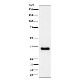Western blot testing of human A431 cell lysate with CCNH antibody. Predicted molecular weight ~38 kDa.