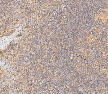 IHC testing of FFPE human tonsil tissue with HLA-B antibody. HIER: steam section in pH6 citrate buffer for 20 min and allow to cool prior to staining.