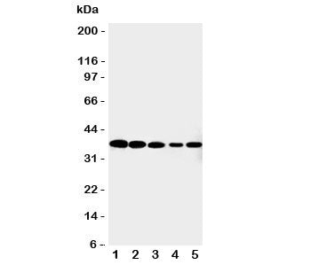Western blot testing of Cdk7 antibody and Lane 1: HeLa; 2: MCF-7; 3: A549; 4: COLO320; 5: Jurkat cell lysate. Expected/observed molecular weight ~37 kDa.