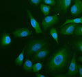 Immunofluorescent staining of ABR using anti-ABR antibody (green). ABR was detected in an immunocytochemical section of human A549 cells. Enzyme antigen retrieval was performed using IHC enzyme antigen retrieval reagent for 15 mins. The cells were blocked with 10% goat serum. And then incubated with 5 ug/ml rabbit anti-ABR antibody overnight at 4oC. DyLight 488 Conjugated Goat Anti-Rabbit IgG was used as secondary antibody at 1:500 dilution and incubated for 30 min at 37oC.