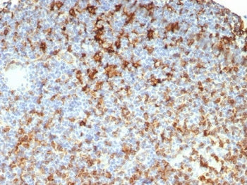 IHC staining of FFPE human lymph node tissue with HLA-DR antibody (clone HLA-DRB/7795R). HIER: boil tissue sections in pH 9 10mM Tris with 1mM EDTA for 20 min and allow to cool before testing.