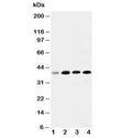 Western blot testing of IGFBP3 antibody and Lane 1: 293T; 2: MCF- 7; 3: A549; 4: SW620. Expected molecular weight: ~31/40-44 kDa (unmodified/glycosylated).