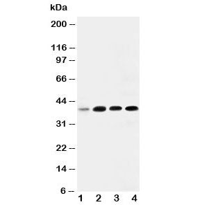 Western blot testing of IGFBP3 antibody and Lane 1: 293T; 2: MCF- 7; 3: A549; 4: SW620. Expected molecular weight: ~31/40-44 kDa (unmodified/glycosylated).