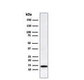 Western blot testing of human HeLa cell lysate with recombinant Galectin 1 antibody (clone GAL1/2499R). Expected molecular weight ~14 kDa.