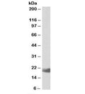 Western blot testing of human lymph node lysate with IL17C antibody at 0.3ug/ml. Predicted molecular weight: ~22 kDa.