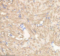 IHC staining of zebrafish Pgam1a/b protein using Zebrafish Pgam1 antibody, HRP-labeled secondary and DAB substrate. Pgam1 was detected in a paraffin-embedded section of zebrafish heart tissue. HIER: boil tissue sections in pH8 EDTA for 20 min and allow to cool before testing.