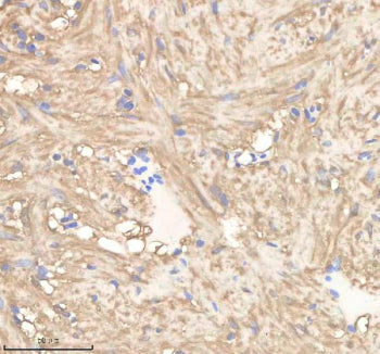 IHC staining of zebrafish Pgam1a/b protein using Zebrafish Pgam1 antibody, HRP-labeled secondary and DAB substrate. Pgam1 was detected in a paraffin-embedded section of zebrafish heart tissue. HIER: boil tissue sections in pH8 EDTA for 20 min and allow to cool before testing.