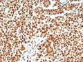 IHC staining of FFPE human lymph node tissue with Ku80 antibody (clone XRCC5/8093R). HIER: boil tissue sections in pH 9 10mM Tris with 1mM EDTA for 20 min and allow to cool before testing.