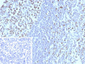 IHC staining of FFPE human tonsil tissue with MCM3 antibody (clone MCM3/8972R). Inset: PBS used in place of primary Ab (secondary Ab negative control). HIER: boil tissue sections in pH 9 10mM Tris with 1mM EDTA for 20 min and allow to cool before testing.