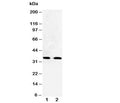 Western blot testing of Cdk5 antibody and Lane 1: HeLa; 2: Jurkat cell lysate