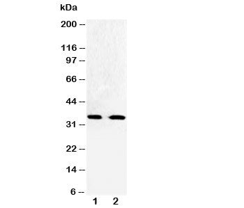 Western blot testing of Cdk5 antibody and Lane 1: HeLa; 2: Jurkat cell lysate