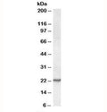 Western blot testing of NIH3T3 lysate with SAR1 antibody at 0.1ug/ml. Predicted molecular weight: ~22 kDa.