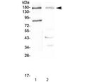 Western blot testing of 1) rat pancreas and 2) mouse NIH 3T3 lysate with NPC1 antibody at 0.5ug/ml. Expected molecular weight: 140-190 kDa depending on glycosylation level.
