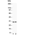 Western blot testing of Bcl2A1 antibody and (1) HeLa, (2) Jurkat lysate. Predicted molecular weight: ~20kDa but may be observed at up to ~37kDa.