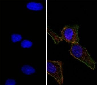 Right: Confocal Immunofluorescent analysis of SK-OV-3 cells using AF488-labeled EpCAM antibody (EGP40/826) (Green). F-actin filaments were labeled with DyLight 554 Phalloidin (red). Left: Negative control. DAPI was used to stain the cell nuclei (blue).