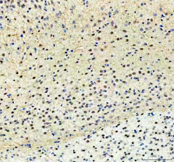 IHC staining of FFPE mouse brain tissue with PKC beta antibody. HIER: boil tissue sections in pH8 EDTA for 20 min and allow to cool before testing.