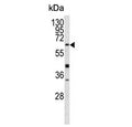 Western blot testing of mouse heart tissue lysate with Glutathione hydrolase 5 proenzyme antibody. Predicted molecular weight ~62 kDa.