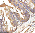 IHC staining of zebrafish Hand2 protein using Zebrafish Hand2 antibody, HRP-labeled secondary and DAB substrate. Hand2 was detected in a paraffin-embedded section of zebrafish colon tissue. HIER: boil tissue sections in pH8 EDTA for 20 min and allow to cool before testing.