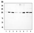 Western blot testing of 1) rat skeletal muscle, 2) rat liver, 3) rat lung, 4) rat RH35, 5) mouse skeletal muscle, 6) mouse liver, 7) mouse lung and 8) mouse NIH 3T3 cell lysate with ACTN4 antibody at 0.5ug/ml. Predicted molecular weight ~105 kDa.