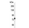 Western blot testing of human CEM cell lysate with ATF7IP2 antibody. Predicted molecular weight ~76 kDa.