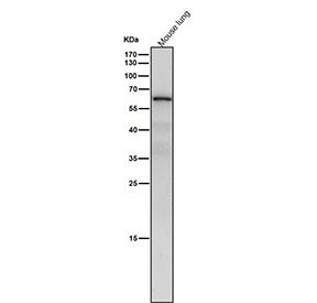 Mouse lung tissue lysate western blot tested with the NR2C2 antibody at 1:4000 dilution for 1 hour at room temperature. Predicted molecular weight: 65-67 kDa (two isoforms).