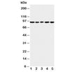 Western blot testing of MCM6 antibody and Lane 1: U87; 2: COLO320; 3: HeLa; 4: MCF-7; 5: Jurkat cell lysate. Expected molecular weight: 92-105 kDa.